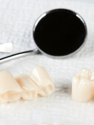 How Long Will a Baby Dental Crown Remain?