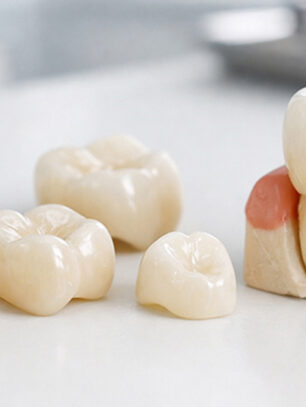 How Pediatric White Aesthetic Crowns Restore Damaged Baby Teeth Naturally