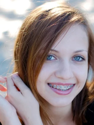 How Orthodontics Can Help Children With Crossbite or Overbite Issues