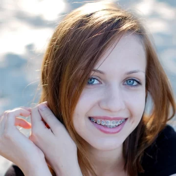 How Orthodontics Can Help Children With Crossbite or Overbite Issues